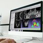 Guided surgery planning software displaying CBCT scan data on a monitor