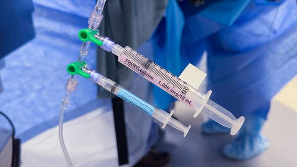 Prepared anesthesia syringes on a sterile field for IV sedation