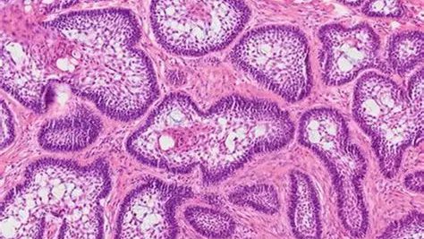 Histology slide used in oral pathology diagnosis