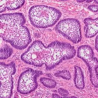 Histology slide used in oral pathology diagnosis