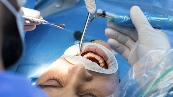 Patient undergoing an airway evaluation for obstructive sleep apnea
