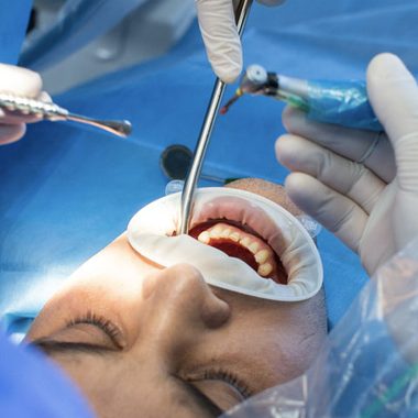 Patient undergoing an airway evaluation for obstructive sleep apnea