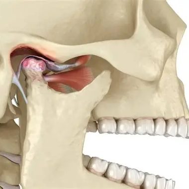 Anatomical illustration of the temporomandibular joint